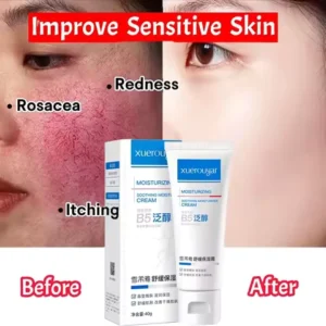 B5 Repair Facial Redness Cream Instant Spider Vein Remove Sensitive Skin Sooth Anti Redness Rosacea Treat Lotion Korean Cosmetic