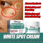 eelhoe Niacinamide Melasma Brightening Cream Reduce Melanin Brighten Cream Lighten Dark Skin Chloasma Serum Fade Fine Face Lines
