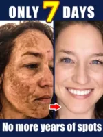 Effectively lightens dark spots and restores facial skin Suitable for all ages